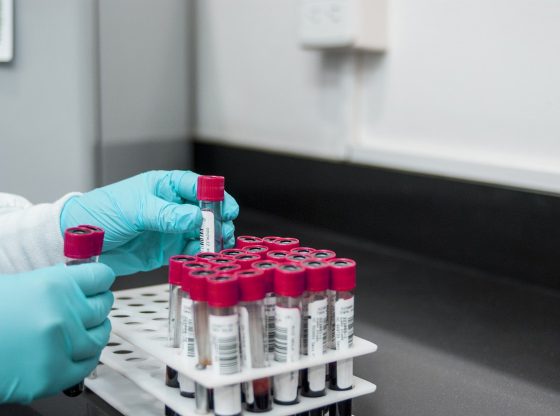 badania laboratoryjne poznań