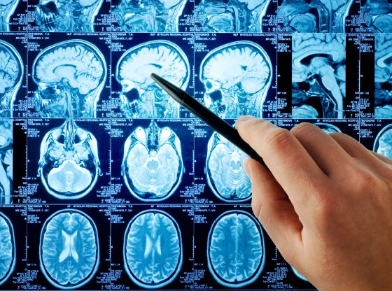 rezonans magnetyczny głowy